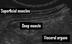 Ultrasound graphic